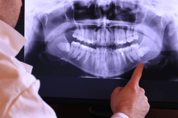 Best Emergency Tooth Extraction in Green Level, NC