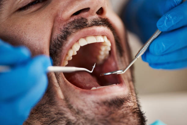Best Pediatric Emergency Dentist in Green Level, NC